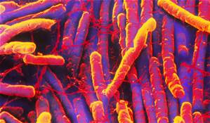 Preliminary C. Difficile Study Findings at ARTA Conference